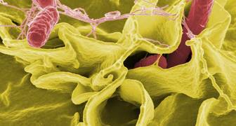 BACTERIA DE LA SALMONELA