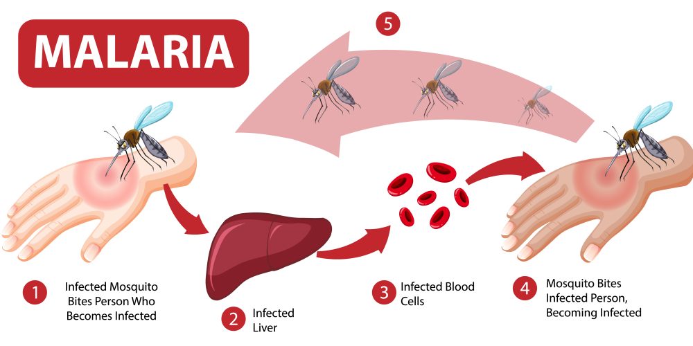 Malaria symptom information infographic illustration