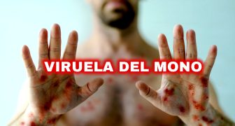 PERIODO DE INCUBACIÓN DE LA VIRUELA DEL MONO