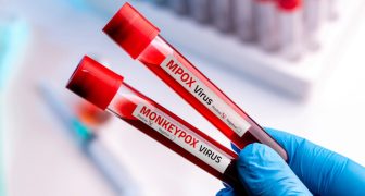 Viruela del Mono o Mpox