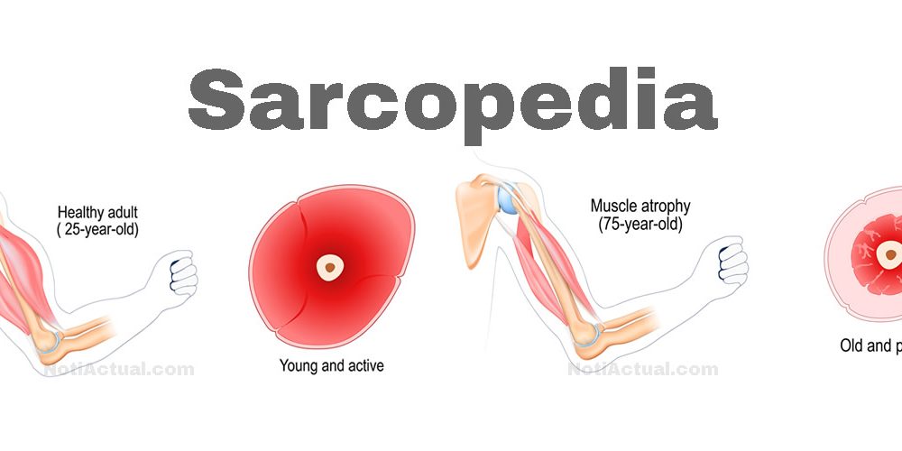 SUPLEMENTOS Y VITAMINAS PARA LA PERDIDA MUSCULAR sarcopedia